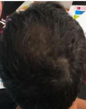Champú y acondicionador para el crecimiento del cabello con queratina brasileña, conjunto para mejorar el crecimiento del cabello, regalos, previene el cuidado de las mujeres de 200ml