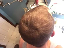 PURC-pulverizador para el crecimiento del cabello para hombres y mujeres, tratamiento para la pérdida de cabello de rápido crecimiento, productos de belleza para el cuidado del cabello, 30ml