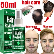 

New Ginger Hair Growth Essential Spray Anti Hair Loss Serum 7 Days Effective Germinal Repair Growing Treatment Liquid