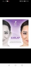 Beauty Tapes-Corrector para orejas, sistema de sujeción para las orejas, duradero, efecto instantáneo