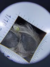 Lupa con mango de dermatoscopio 10X, visión clara suave con escala de medida, 30X, tipo B, visión más grande con luz UV