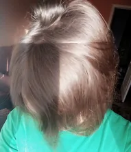 Esencia rápida y potente para el crecimiento del cabello, productos para la pérdida del cabello, tratamiento líquido de aceite esencial, productos para el cuidado del cabello, 20ml