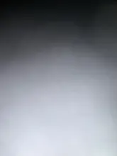 Removedor de espinillas y nariz con acné, utensilio para quitar espinillas y comedones, aguja para quitar acné, acero inoxidable