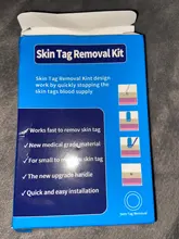 Kit de eliminación de verrugas y microbanda para la piel, eliminador de verrugas con hisopo de limpieza, topos y verrugas para adultos, cuidado facial