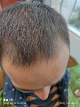 Esencia de crecimiento rápido del cabello, tratamiento Natural Herbal para la pérdida de cabello, hace que el crecimiento del cabello sea más largo y más grueso, productos para el cuidado del cabello, 60ml