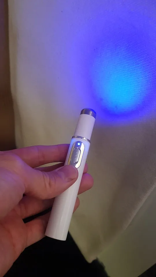 Blue Light Laser Pen for Spots, Scars & Blemishes photo review