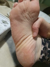 Foot-Care-Tool Skin-Removal Cracked-Heels Electric 5-Rollers with Dead-Dry for Cuticles