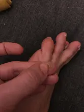 Parches médicos para el cuidado de los pies, almohadillas de eliminación de maíz, espinillas, parches curativos, elimina callosidades, desintoxicación, 30 Uds.