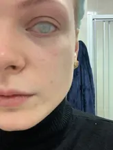 Lentes de contacto ciegos para pupila, Color puro, Color blanco, Cosplay de Halloween, para maquillaje de ojos, 14,5mm