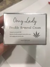 Freckle-Removal-Cream Whitening Remove-Freckle Melanin Dark-Spot Anti-Aging Omy Lady