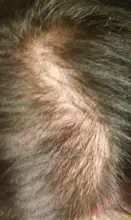 Suero para el crecimiento del cabello de jengibre, tratamiento para la pérdida del cabello con Spray, aceite esencial para el crecimiento del cabello Germinal efectivo en 7 días, cuidado del cabello para hombres y mujeres, 30ml