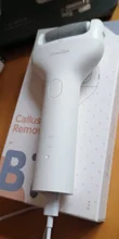 Showsee-Lima eléctrica para pies, removedor de callos al vacío, herramientas profesionales de pedicura, lijadora eléctrica para pies, B1-W para el cuidado de la piel