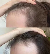 Liquid Spray Hair-Loss-Products Essential-Oil Dry-Hair Omy Lady Regeneration-Repair 