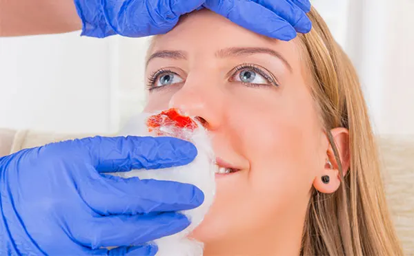 孕妇流鼻血是怎么回事 孕妇流鼻血的原因