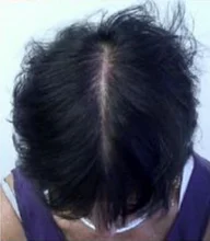 HAIRCUBE-esencia para el crecimiento del cabello para hombres y mujeres, suero para el crecimiento del cabello, Germinal rápido, cuidado del cabello, reparación, líquido antipérdida de cabello más grueso