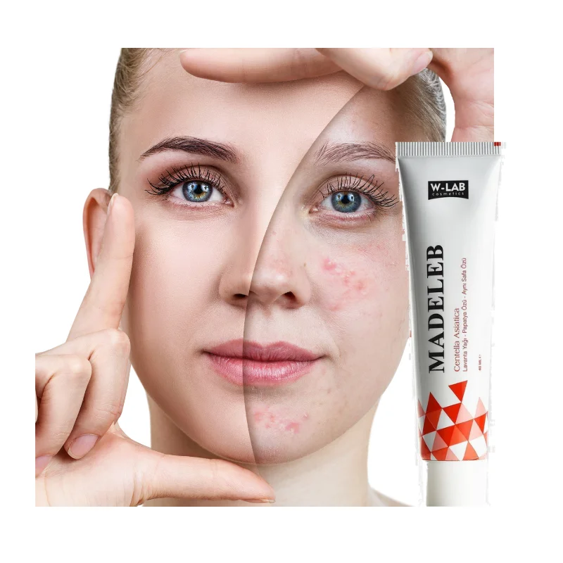 Madeleb W-Lab Skin Renewal Cream 40 Ml Skin Wounds Psoriasis Eczema Acne Problems Cell Regeneration 1