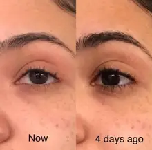 LANBENA-suero Facial blanqueador con vitamina C, esencia para la piel que aclara las manchas, elimina manchas oscuras y pecas