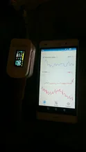 Oxímetro De pulso para la yema del Dedo, Monitor inteligente De saturación De oxígeno en sangre, con Bluetooth 4,0, HRV SpO2, Android IOS CE