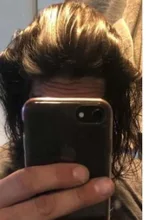 REAGAIN prevenir la pérdida de cabello productos para el crecimiento del cabello esencia crecer restauración