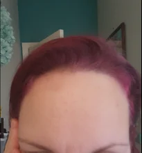 LANBENA-suero Facial blanqueador con vitamina C, esencia para la piel que aclara las manchas, elimina manchas oscuras y pecas