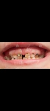 Cabezales de repuesto de cepillo de dientes para niños, EB-10A Oral B Pro-Health, cepillo para cuidado dental eléctrico, 3D Excel, 12 Uds.
