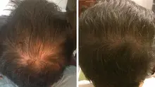 Tonic Product Hair-Care-Set Hair-Loss-Nourishing Strong-Hair Men/women of All-Hair-Types