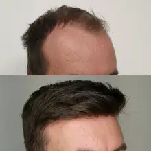 Peluca de cabello humano para hombre, tupé de piel sintética con sistema de cabello fino suave de 0,06mm de grosor, hecha a mano, con prótesis capilar Natural