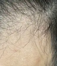 Suero para el crecimiento del cabello de jengibre, tratamiento para la pérdida del cabello con Spray, aceite esencial para el crecimiento del cabello Germinal efectivo en 7 días, cuidado del cabello para hombres y mujeres, 30ml