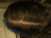 HAIRCUBE-esencia para el crecimiento del cabello, tratamiento para la pérdida del cabello, anticaída, prevención, Alopecia, líquido dañado, reparación del cabello