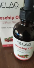 Essential-Oil Lavender Rosehip Body-Massage Organic MELAO for Facial Moisturizer 118ml