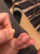 Parches médicos para el cuidado de los pies, almohadillas de eliminación de maíz, espinillas, parches curativos, elimina callosidades, desintoxicación, 30 Uds.