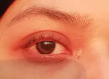 Easylittle-lentillas de colores para los ojos, lentillas de colores para los ojos, lentillas de belleza pequeñas, graduadas, 2 uds.