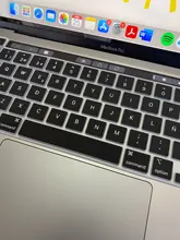 Crystal Hard Case For Macbook Air 13 Retina Pro 13 15 16 2020 A2289 A2159 Hard Cover