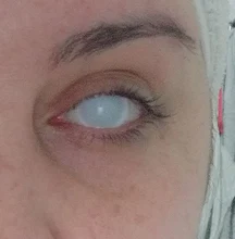 Lentes de contacto para Cosplay, lentillas de Color rojo y blanco para ojos de Halloween, 1 par