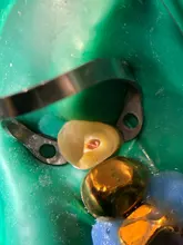 1 PC Dental ortodoncia doble espejos de dos lados Reflector odontología Intra Oral de vidrio recubierto de titanio Dental fotografía espejos