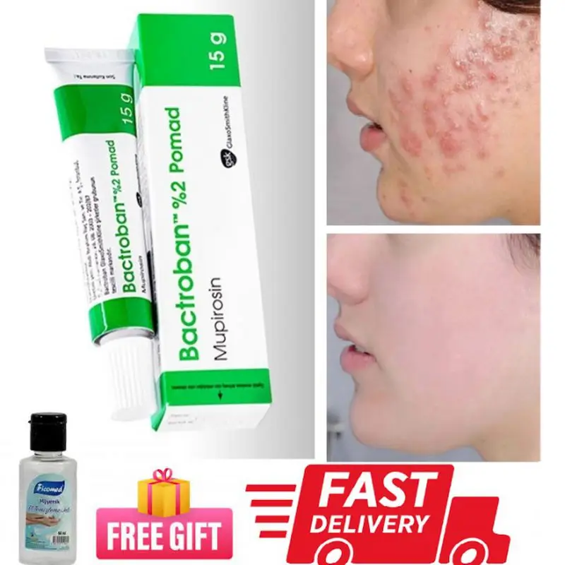 Bactroban Effective Acne Removal Cream Treatment Fade Acne Spots Oil