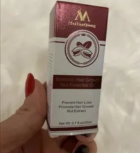 Aceite potente para el crecimiento del cabello para hombres y mujeres, productos para evitar la pérdida del cabello, tratamiento líquido de esencia, champú reparador, cuidado del cabello, 20ml