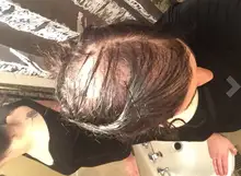 Aceite de esencia de crecimiento de pelo rápido, suero para el crecimiento del cabello de jengibre, tratamiento nutritivo para suavizar la pérdida de cabello, reparación de cabello dañado, 10/30ML, 7 días