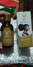 Esencia De rápido crecimiento De pelo, productos Para la pérdida del cabello, Fibras Para el crecimiento del cabello, champú, crema De tratamiento Para el cuidado del cabello