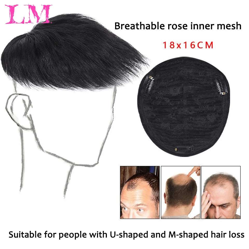 Hair Loss Human Hair Quotes Pattern Baldness Clip On Man Bun Clip