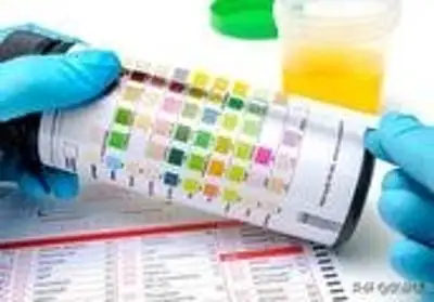 尿蛋白“+”是什么情况？到底要不要处理？肾内科医师一文讲清楚