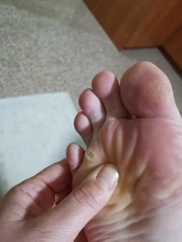 Parches médicos para el cuidado de los pies, almohadillas de eliminación de maíz, espinillas, parches curativos, elimina callosidades, desintoxicación, 30 Uds.