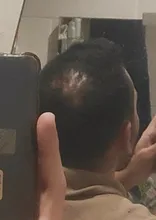 Sevich-corrector para la pérdida del cabello, producto para el cuidado del cabello, tratamiento del cabello con queratina para el crecimiento del cabello, 100g