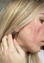 succionador puntos negros removedor limpiador facial eléctric cuidado quita puntos negros de la cara acne limpiador de poros eléctrico eliminador espinillas granos belleza facial mujer cara limpieza facial ultrasonico