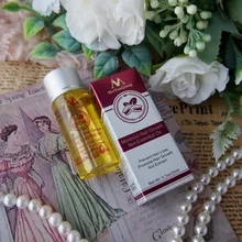 Esencia rápida y potente para el crecimiento del cabello, productos para la pérdida del cabello, tratamiento líquido de aceite esencial, productos para el cuidado del cabello, 20ml