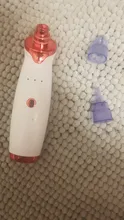 Aparato para limpieza profunda de la piel con espinillas, limpiador con punta de diamante de Zona T para nariz y resto del rostro, para la eliminación de espinillas, succión al vacío