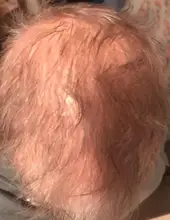 Champú para el crecimiento del cabello para hombres y mujeres, conjunto de regalo, espesante, productos para el cuidado de la caída del cabello, tratamiento de crecimiento del cabello, aceite SÉRUM