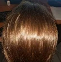 Liquid Spray Hair-Loss-Products Essential-Oil Dry-Hair Omy Lady Regeneration-Repair 