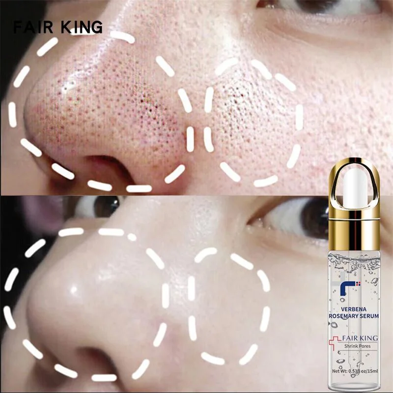 Verbena Rosemary Serum Shrink Pores Against Wrinkles Antiaging Lighten