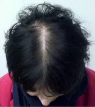 HAIRCUBE-esencia para el crecimiento del cabello para hombres y mujeres, suero para el crecimiento del cabello, Germinal rápido, cuidado del cabello, reparación, líquido antipérdida de cabello más grueso